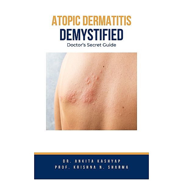 Atopic Dermatitis Demystified: Doctor's Secret Guide, Ankita Kashyap, Krishna N. Sharma