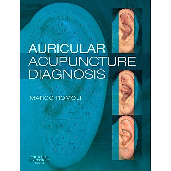 Auricular Acupuncture Diagnosis, Marco Romoli