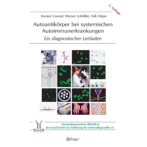Autoantikörper bei systemischen Autoimmunerkrankungen, Karsten Conrad, Falk Hiepe, Werner Schößler