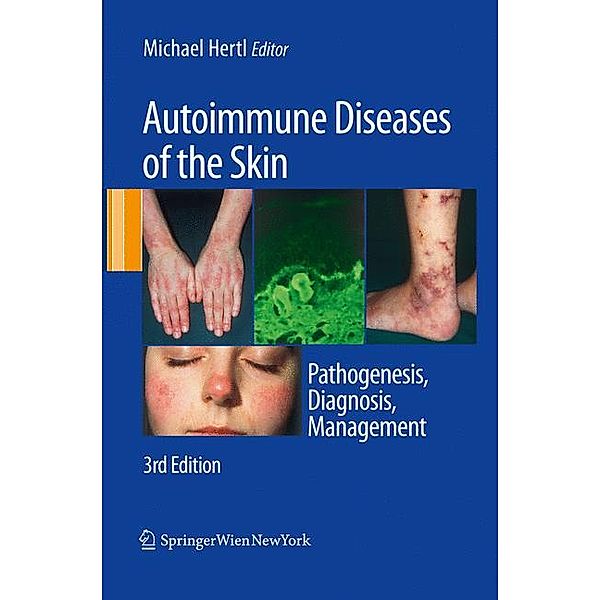 Autoimmune Diseases of the Skin