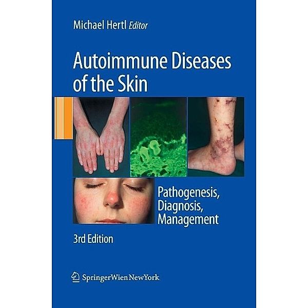 Autoimmune Diseases of the Skin, Michael Hertl