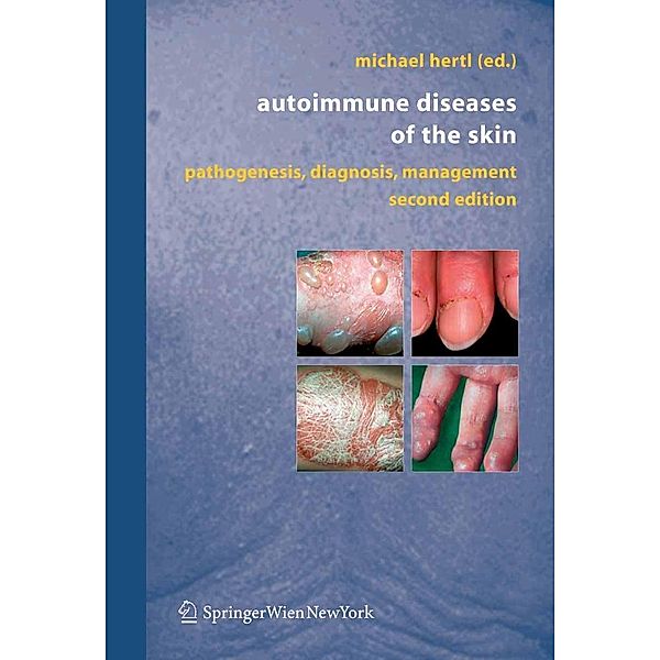 Autoimmune Diseases of the Skin