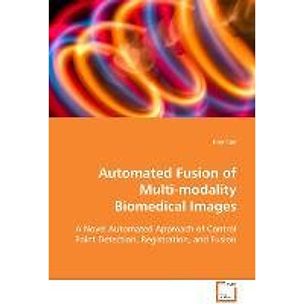 Automated Fusion of Multi-modality Biomedical Images, Hua Cao
