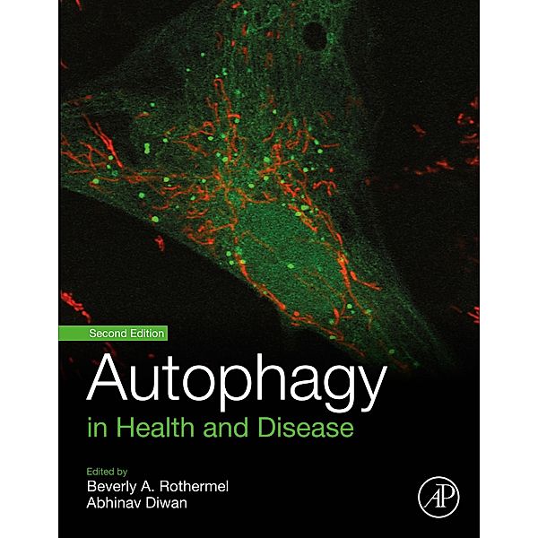 Autophagy in Health and Disease