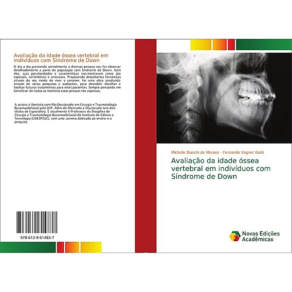 Avaliação da idade óssea vertebral em indivíduos com Síndrome de Down, Michelle Bianchi de Moraes, Fernando Vagner Raldi