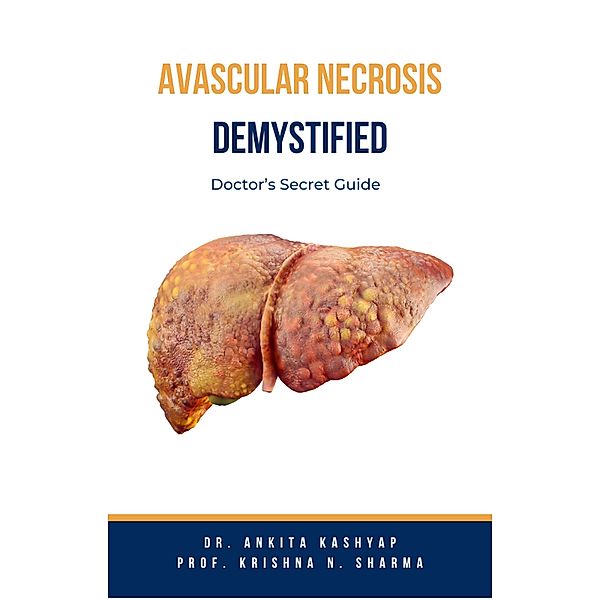 Avascular Necrosis Demystified: Doctor's Secret Guide, Ankita Kashyap, Krishna N. Sharma