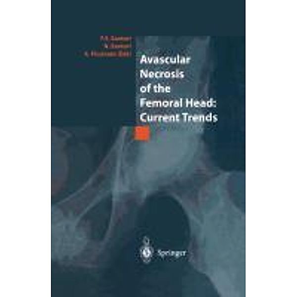 Avascular Necrosis of the Femoral Head: Current Trends