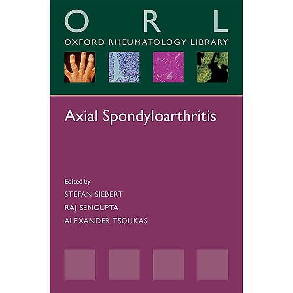 Axial Spondyloarthritis / Oxford Rheumatology Library