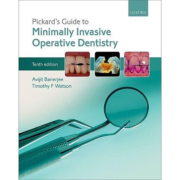 Banerjee, A: Pickard's Guide to Minimally Invasive Operative, AVIJIT BANERJEE, Timothy F. Watson