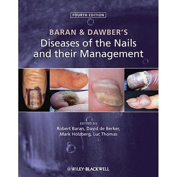 Baran & Dawber's Diseases of the Nails and their Management, Baran