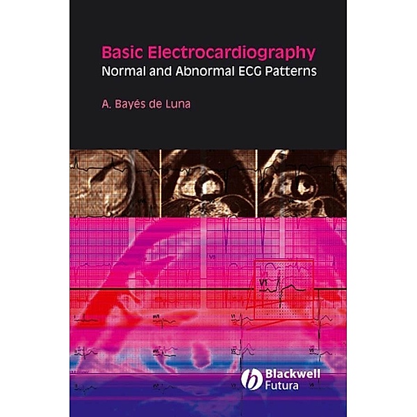 Basic Electrocardiography, Antoni Bayés de Luna