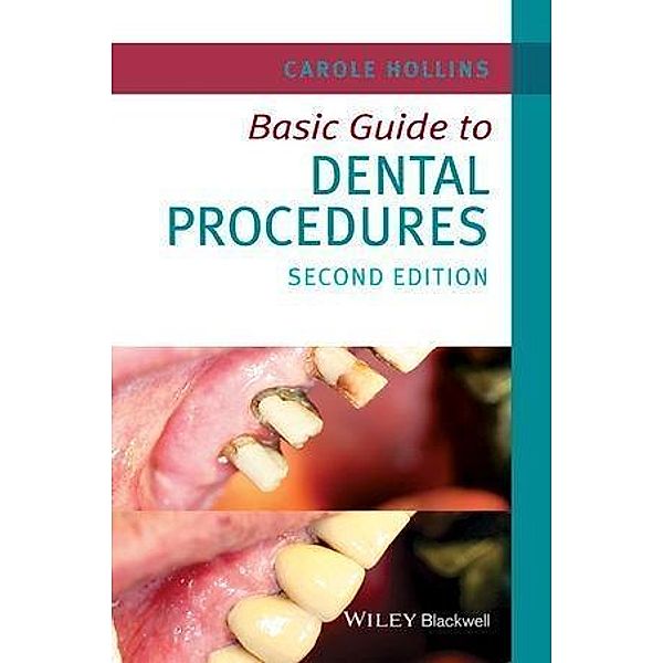 Basic Guide to Dental Procedures, Carole Hollins