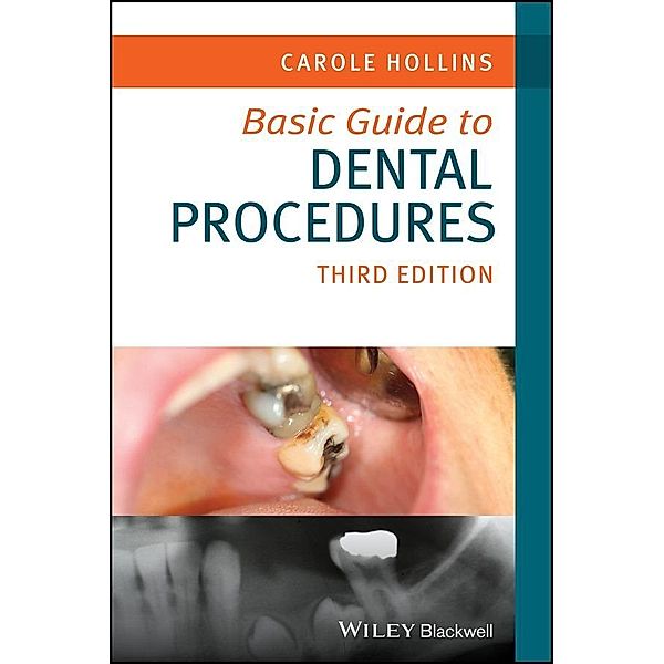 Basic Guide to Dental Procedures, Carole Hollins