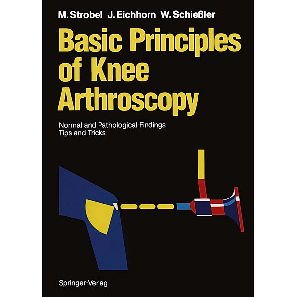 Basic Principles of Knee Arthroscopy, Michael Strobel, Heinz-Jürgen Eichhorn, Wilfried Schießler