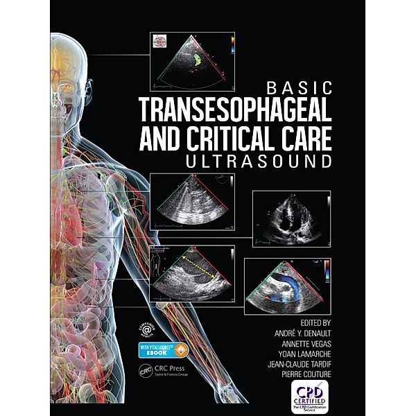 Basic Transesophageal and Critical Care Ultrasound