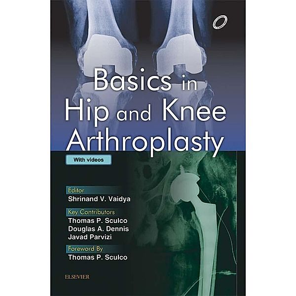 Basics in Hip and Knee Arthroplasty - E-book, Shrinand Vaidya