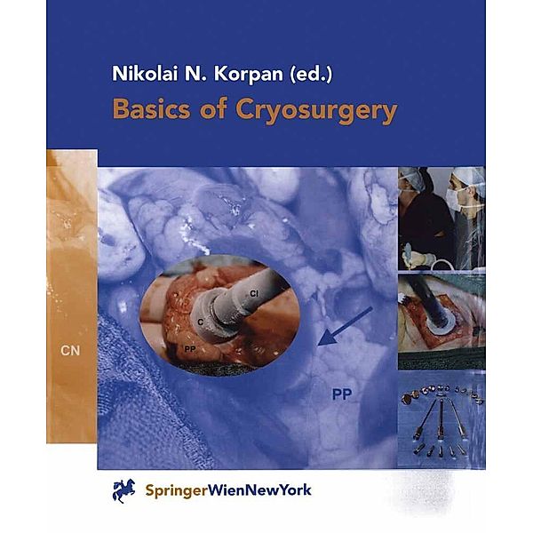 Basics of Cryosurgery