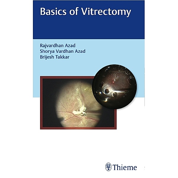 Basics of Vitrectomy
