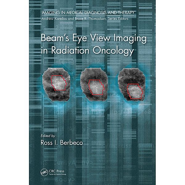 Beam's Eye View Imaging in Radiation Oncology