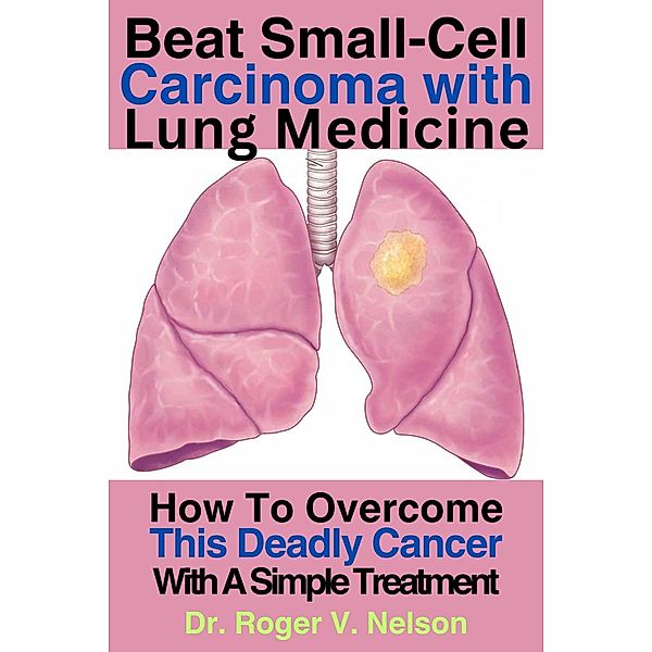 Beat Small-Cell Carcinoma With Lung Medicine, Roger