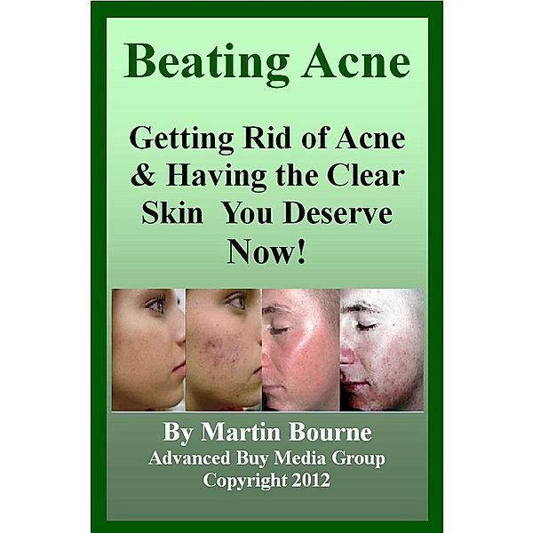 Beating Acne: Getting Rid of Acne & Having the Skin You Deserve Now!, Advanced Buy Media Group