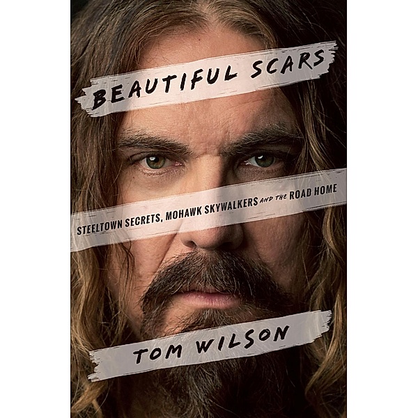 Beautiful Scars, Tom Wilson