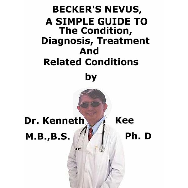 Becker’s Nevus, A Simple Guide To The Condition, Diagnosis, Treatment And Related Conditions, Kenneth Kee