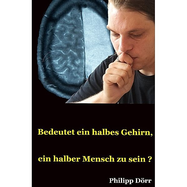 Bedeutet ein halbes Gehirn, ein halber Mensch zu sein?, Philipp Dörr