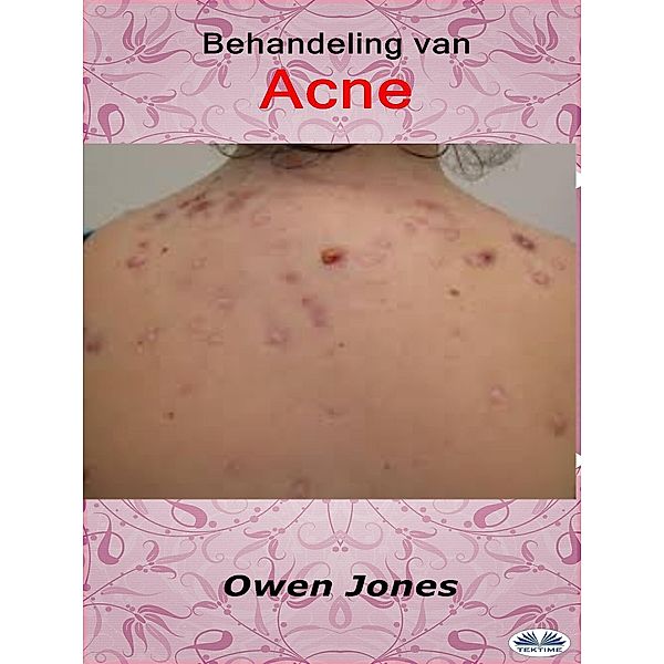 Behandeling Van Acne, Owen Jones