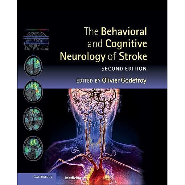 Behavioral and Cognitive Neurology of Stroke