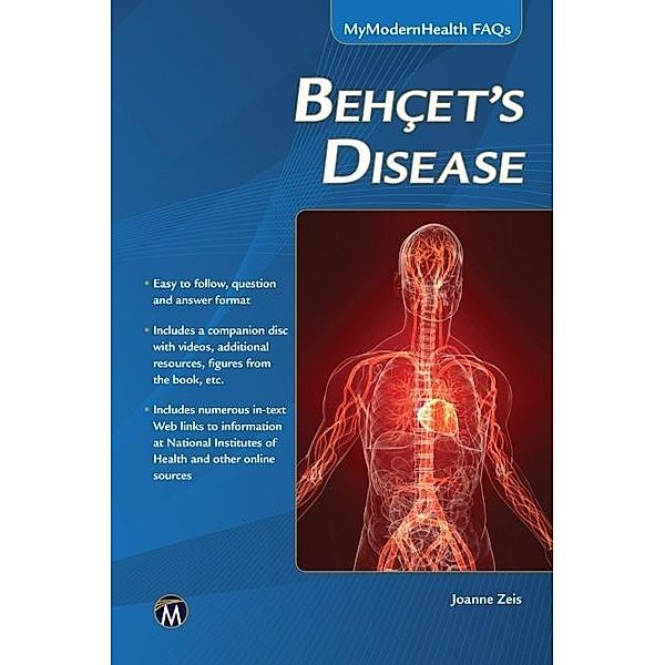 Behcet's Disease / MyModernHealth FAQs, Zeis