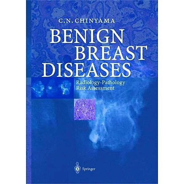 Benign Breast Diseases, Catherine N. Chinyama