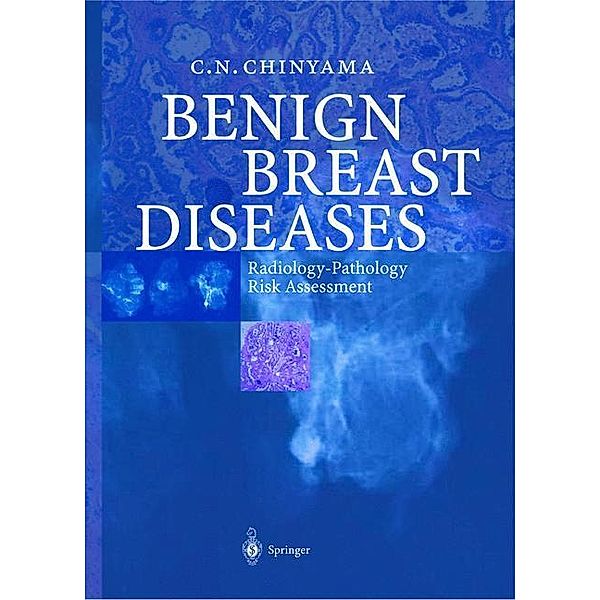 Benign Breast Diseases, Catherine N. Chinyama