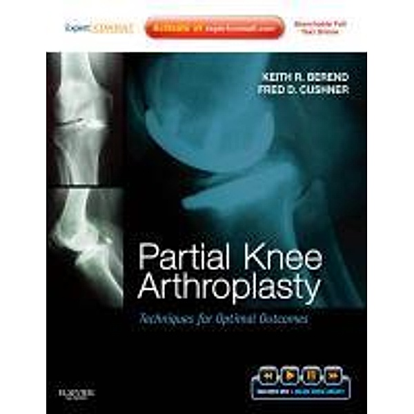 Berend, M: Partial Knee Arthroplasty, Keith R. Berend, Fred Cushner
