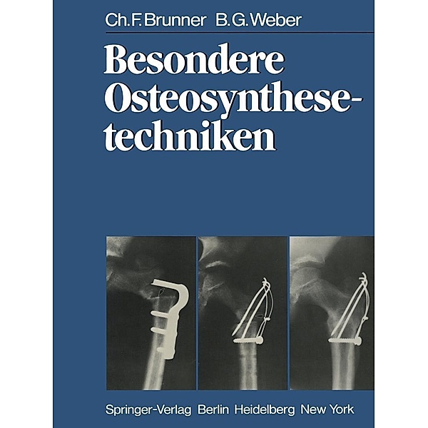 Besondere Osteosynthesetechniken, C. F. Brunner, B. G. Weber