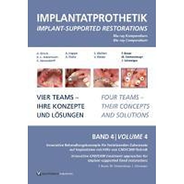 Beuer, F: Blu-Ray-Kompendium Implantatprothetik 4, Florian Beuer, Michael Stimmelmayr, Josef Schweiger