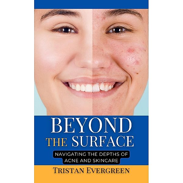 Beyond the Surface, Tristan Evergreen