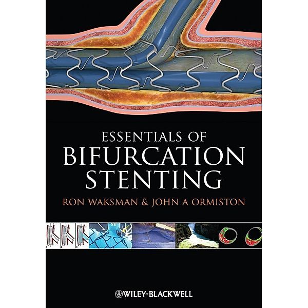 Bifurcation Stenting, Ron Waksman, John Ormiston