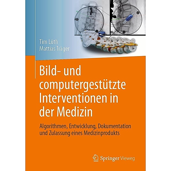 Bild- und computergestützte Interventionen in der Medizin, Tim Christian Lüth, Mattias Felix Träger