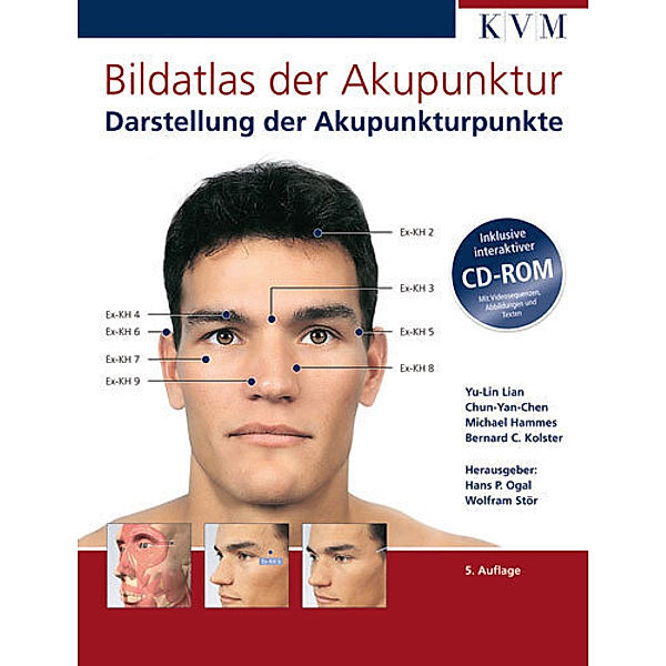Bildatlas der Akupunktur, m. CD-ROM, Yu-Lin Lian, Chun Yan-Chen, Michael Hammes, Bernhard C. Kolster