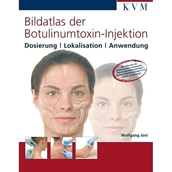 Bildatlas der Botulinumtoxin-Injektion, Wolfgang H. Jost