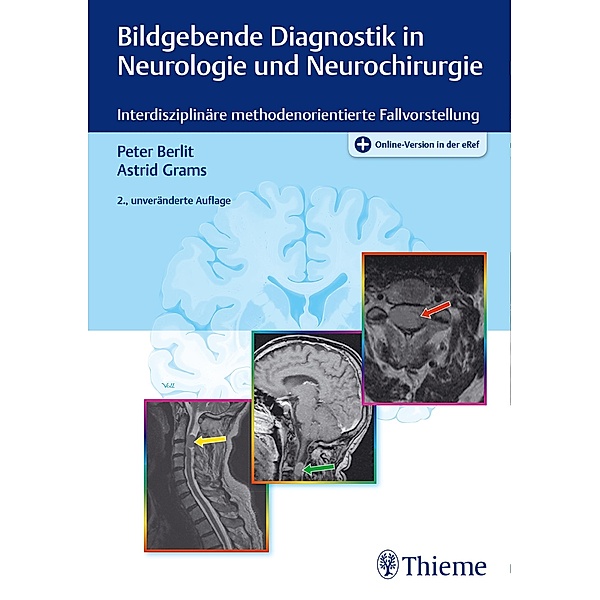 Bildgebende Diagnostik in Neurologie und Neurochirurgie, Peter-Dirk Berlit, Astrid E. Grams