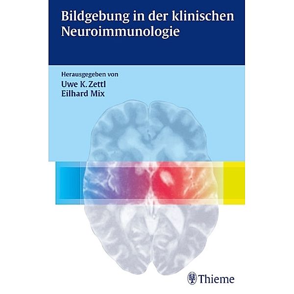 Bildgebung in der klinischen Neuroimmunologie