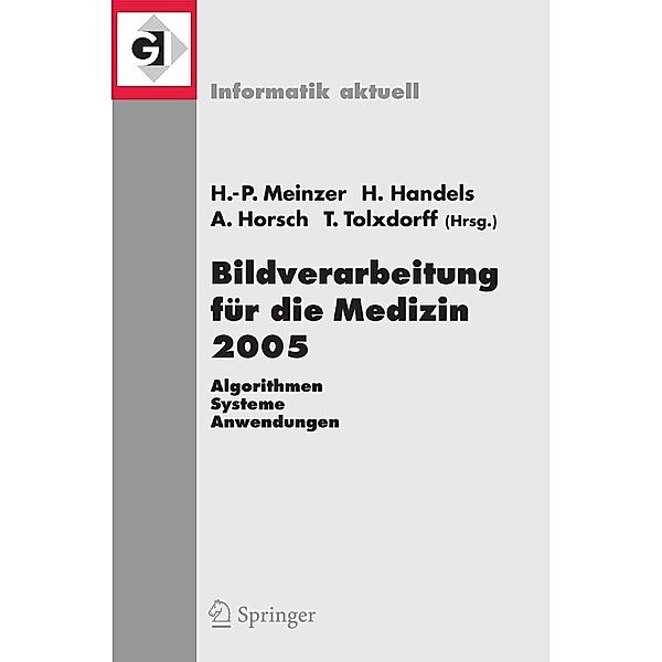 Bildverarbeitung für die Medizin 2005 / Informatik aktuell