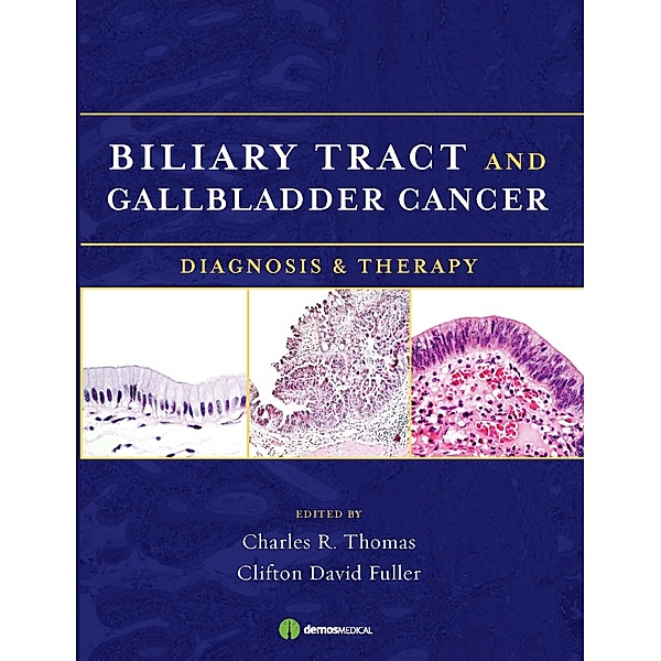 Biliary Tract and Gallbladder Cancer, Clifton D. Fuller, Charles R. Thomas