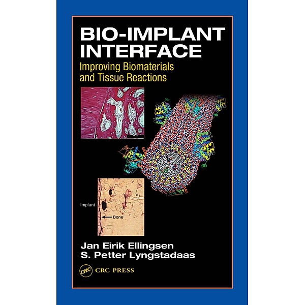 Bio-Implant Interface, J. E. Ellingsen, S. P. Lyngstadaas