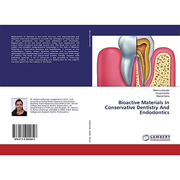 Bioactive Materials In Conservative Dentistry And Endodontics, Mohini Lokhande, Swapnil Kolhe, Meenal Gulve