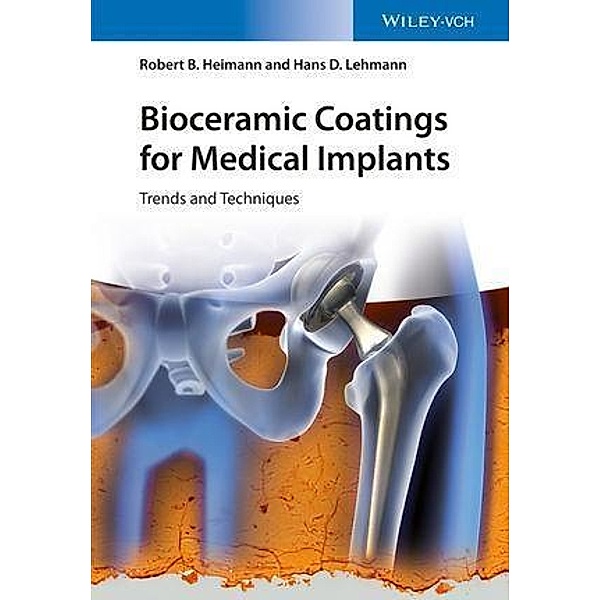 Bioceramic Coatings for Medical Implants, Robert B. Heimann, Hans D. Lehmann