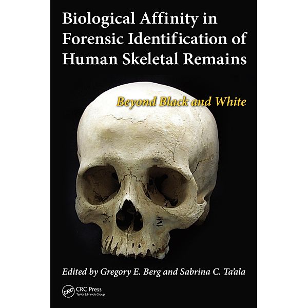 Biological Affinity in Forensic Identification of Human Skeletal Remains