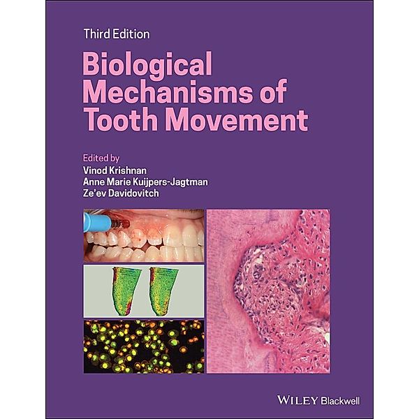Biological Mechanisms of Tooth Movement, Vinod Krishnan, Anne Marie Kuijpers-Jagtman, Ze'ev Davidovitch